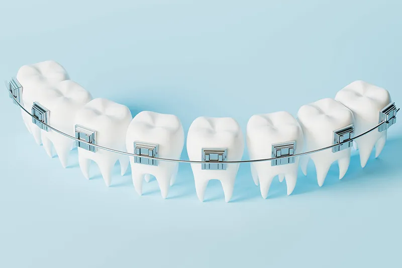 歯並びや噛み合わせを整える矯正治療